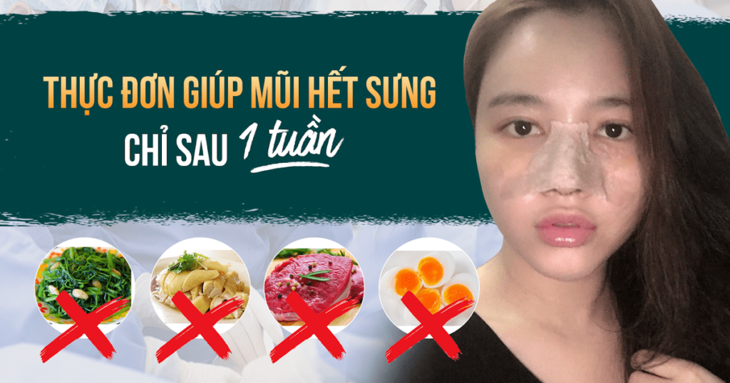 Các thực phẩm nên kiêng sau khi nâng mũi 1 tuần